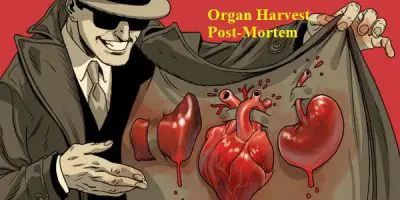 Harvest Organs Post Mortem Mod